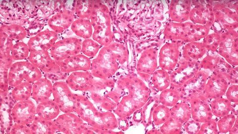 The Journey From Biopsy to Light Microscopy