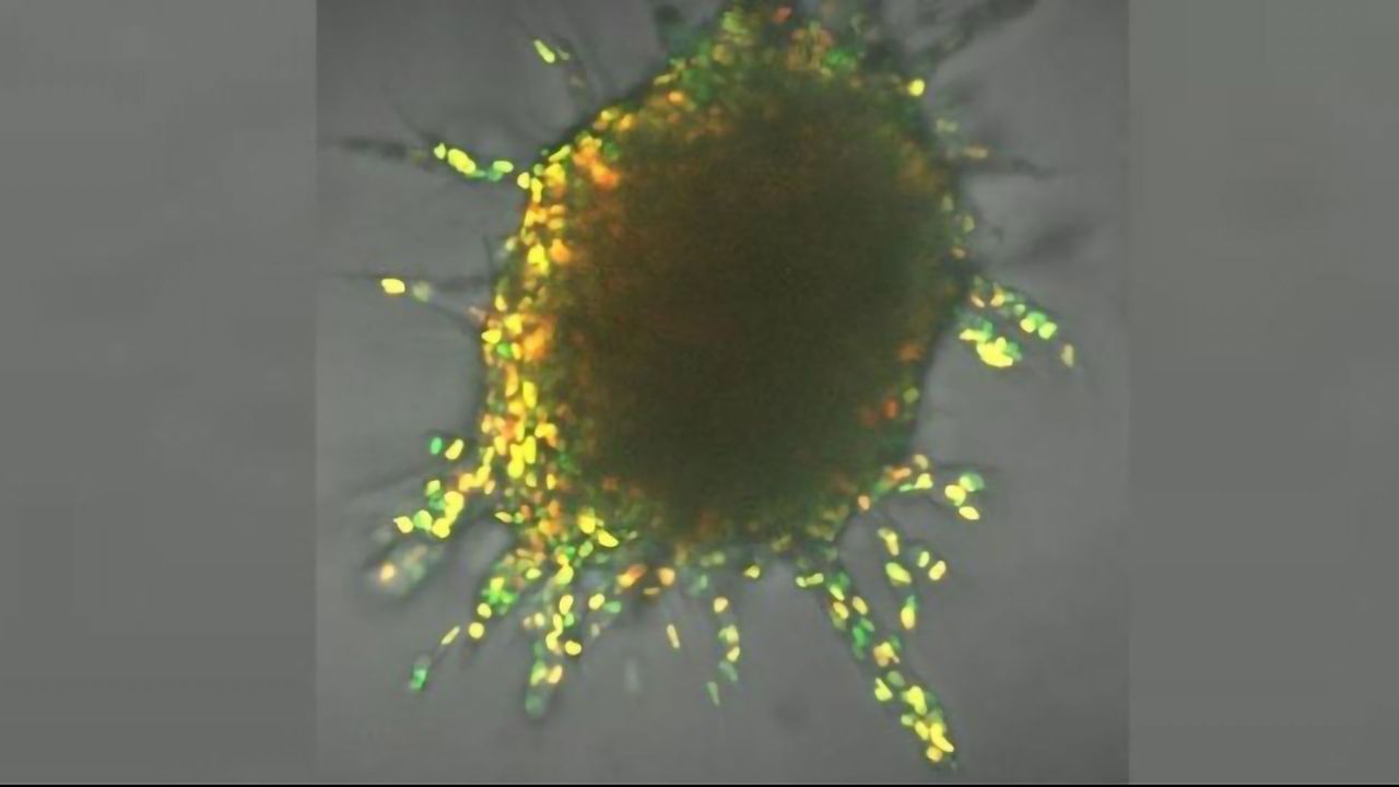 Like Racecars, Cancer Cells Draft Their Way to New Tumor Sites