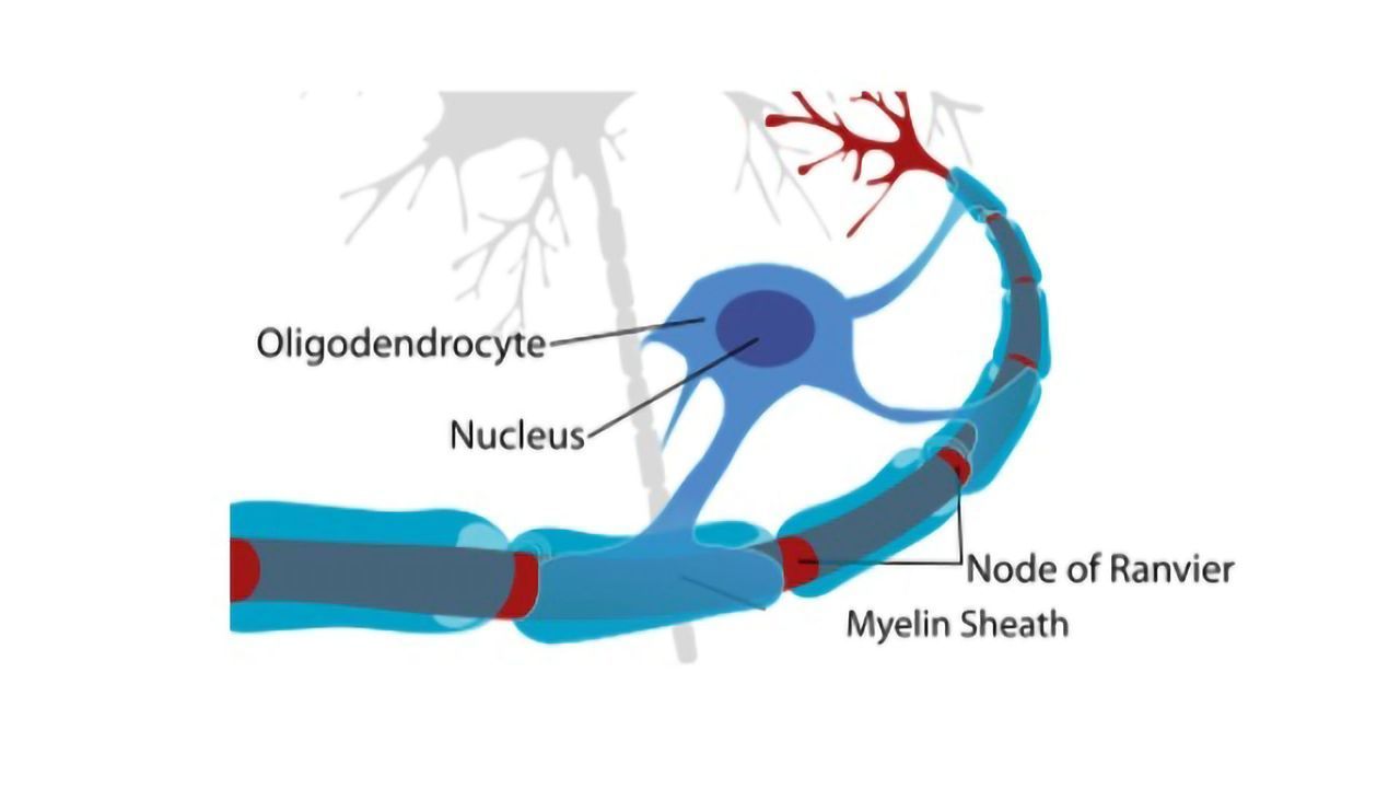Neural Stem Cells Age Faster in MS Patients