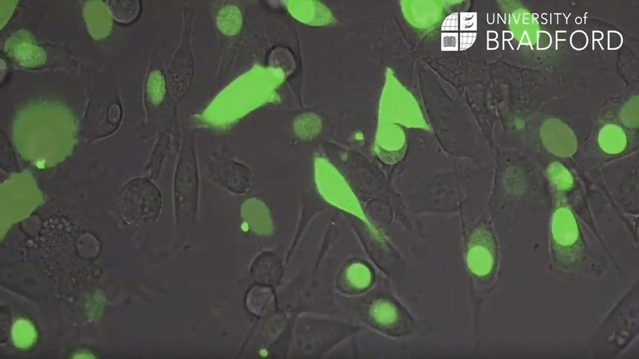 Protein "Spat Out" by Cancer Cells Promotes Tumor Growth