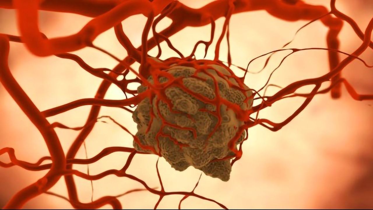 A Protein Critical for the Survival of a Certain Tumor Cell Type Identified