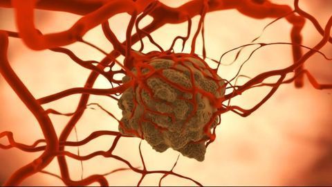 A Protein Critical for the Survival of a Certain Tumor Cell Type Identified