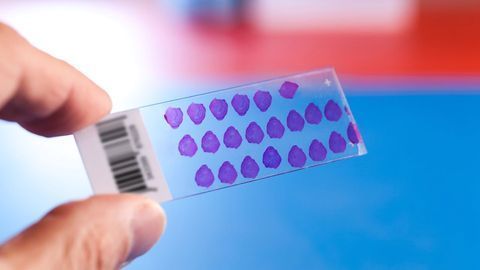 New Tissue Microarrays Conform with FDA Standards