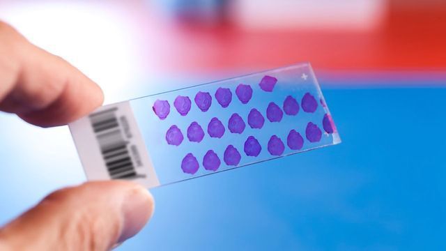 New Tissue Microarrays Conform with FDA Standards content piece image 