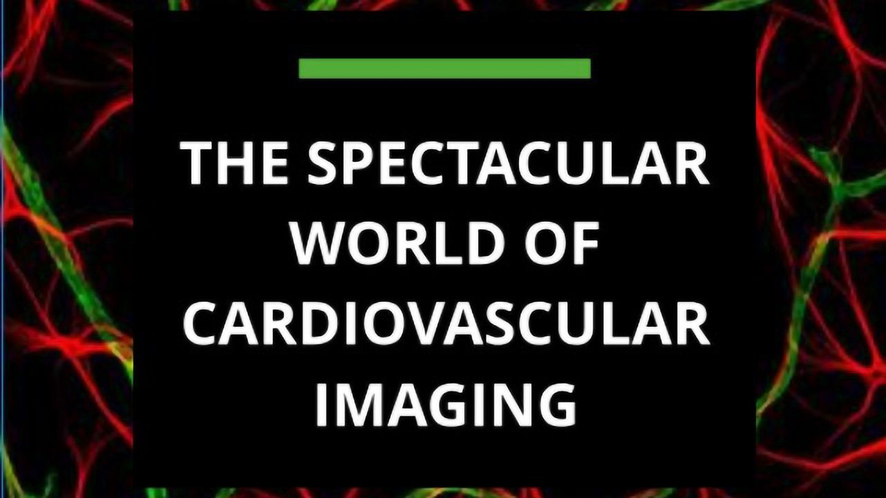The Spectacular World of Cardiovascular Imaging