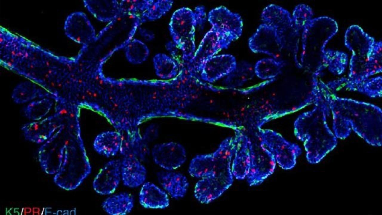 “Moving Target” Breast Cancer Cells Captured Using New Imaging Method