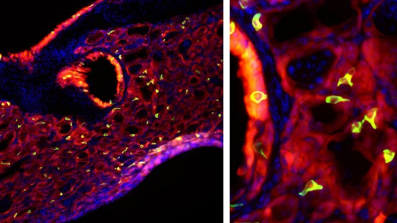 Bad Flu Infection Leads to Surprising "Taste Bud Cell" Discovery