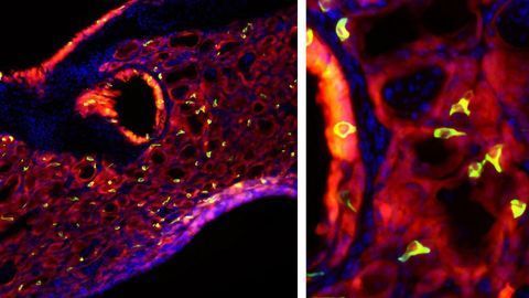 Bad Flu Infection Leads to Surprising "Taste Bud Cell" Discovery