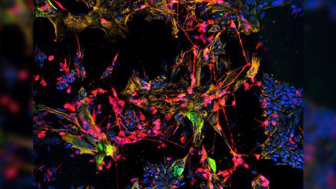 A Stem Cell Model for Nerves in the Nose