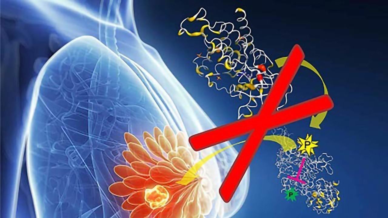 A Targetable Vulnerability in Breast Cancer Cells