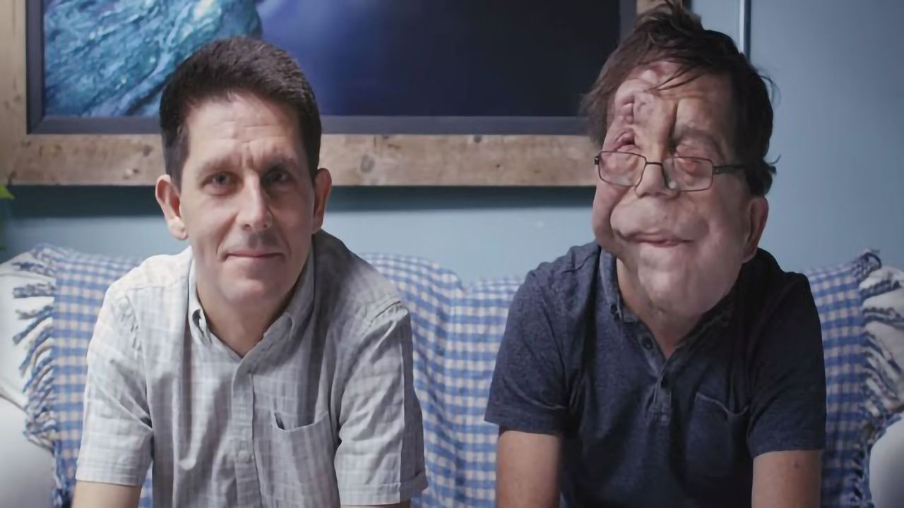 Identical Twins Who Look Nothing Alike