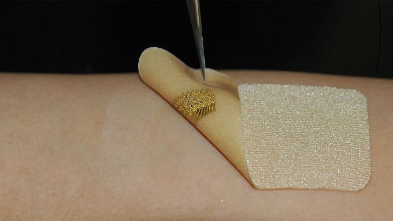 Wearable Sensor Mimics Skin and Monitors Healing Wounds
