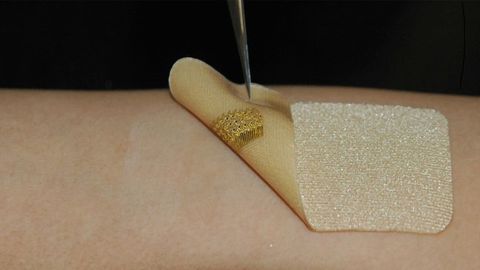 Wearable Sensor Mimics Skin and Monitors Healing Wounds