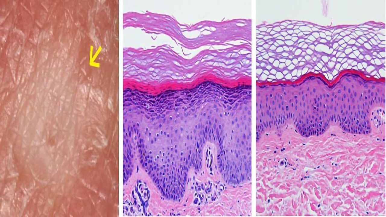 Aging: A Surprising Approach for Eliminating Skin Disease