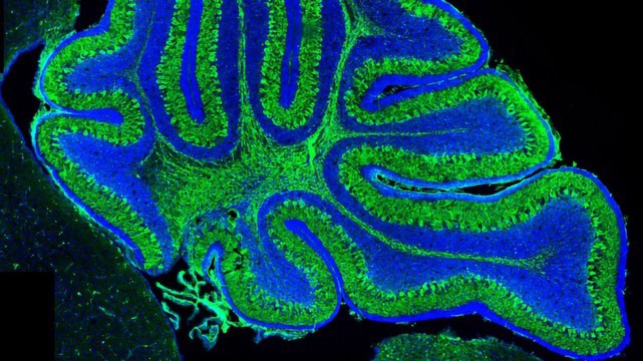 New Mouse Model Replicates Rare Neurological Disease