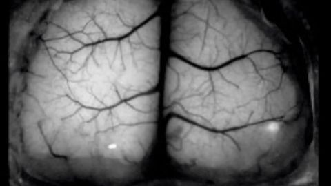 Transparent 3D Printed Skull Provides a Window to the Brain