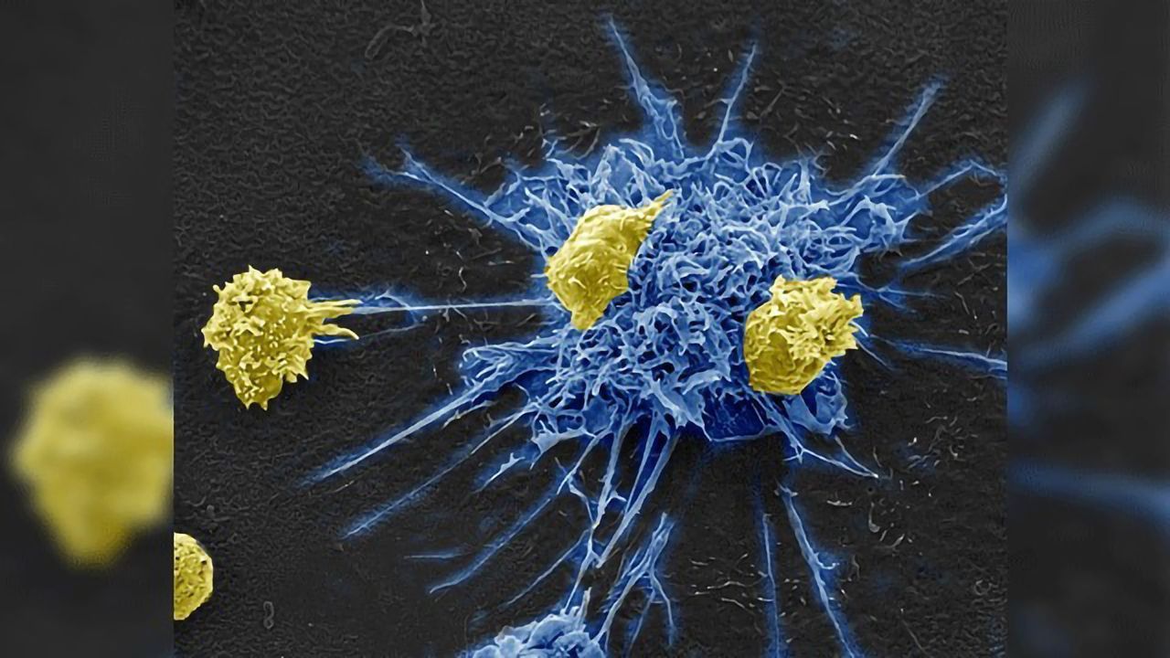 Immunotherapy Pulls HIV Out of Hiding From T Cells