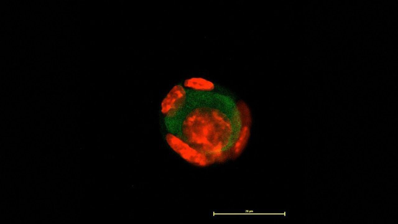 Preserving Fertility After Childhood Cancer a Real Goal