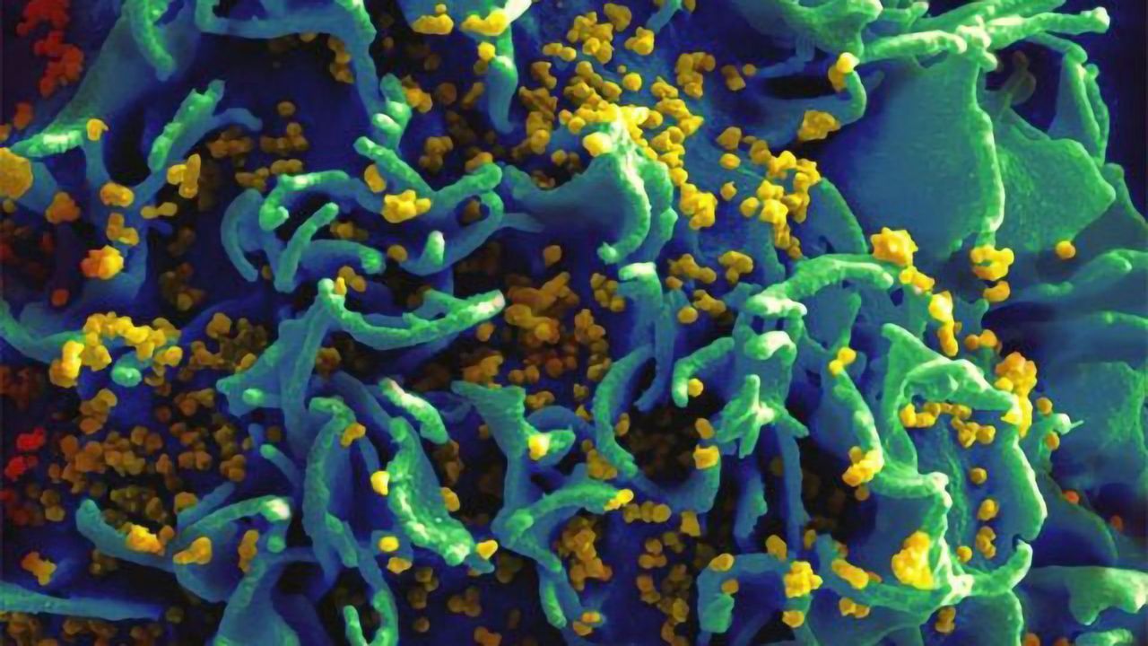 Climbing Infection Rates Linked to Opioid Crisis