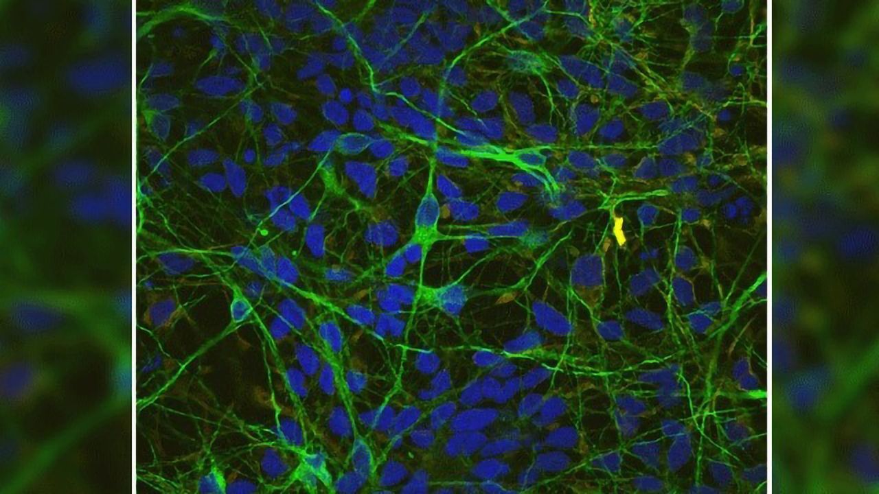 Huntington's Disease Mutation Impairs Protein Needed for Cell Motility