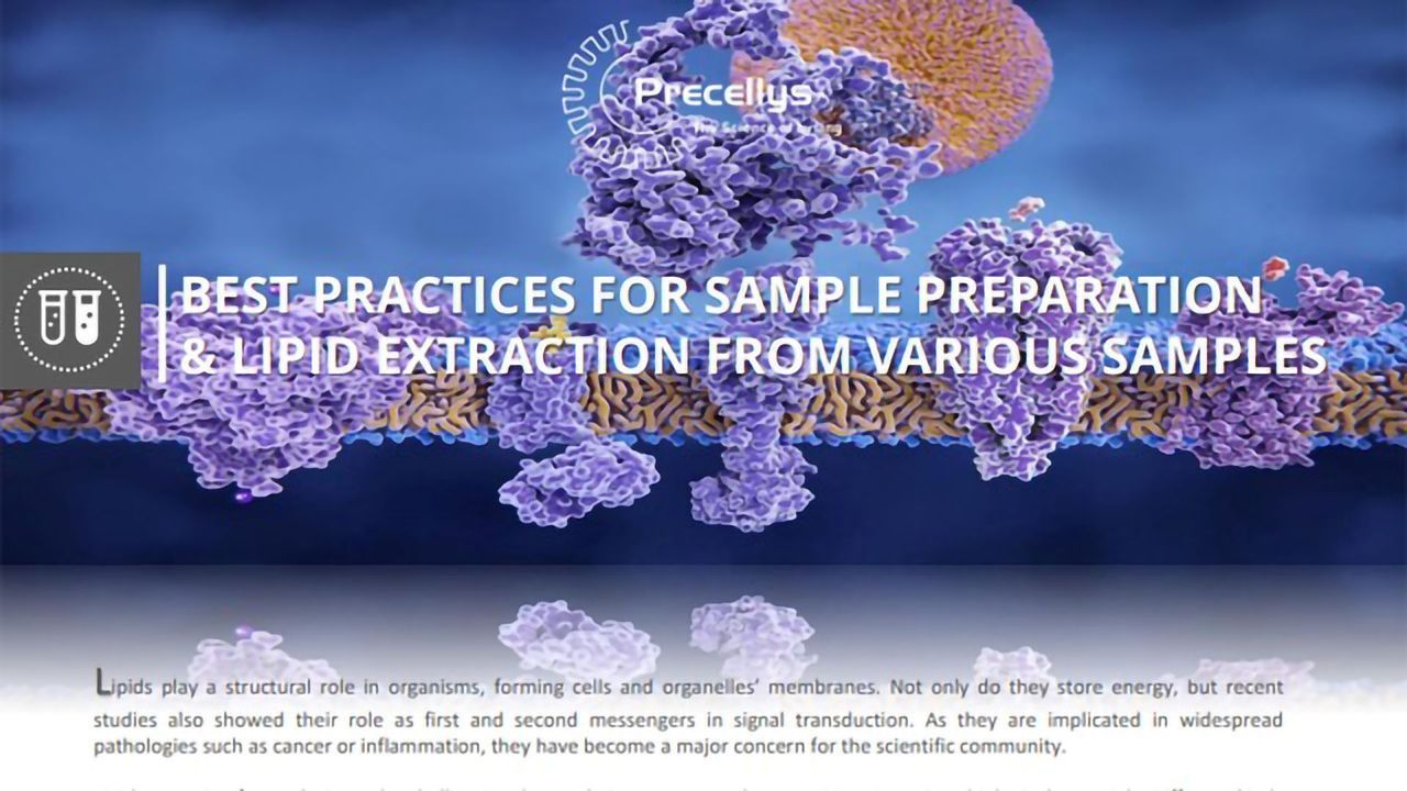 Best Practices for Sample Preparation and Lipid Extraction