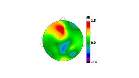 Deep Brain Stimulation Improves Cognitive Control by Enhancing Brain Rhythms