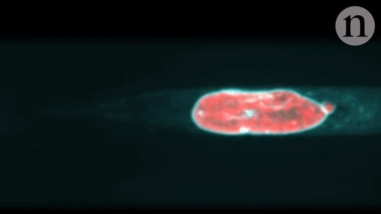 How White Blood Cells Choose the Path of Least Resistance