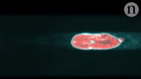 How White Blood Cells Choose the Path of Least Resistance