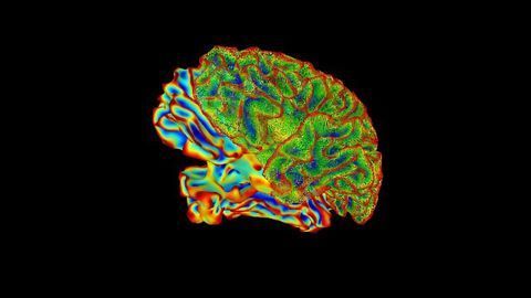 Protein Gives Insight Into Charcot-Marie-Tooth Disease