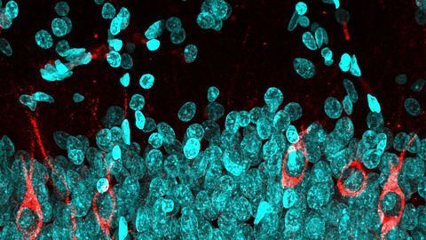New Neurons Until Ninety: Discovering Neurogenesis in the Adult Hippocampus