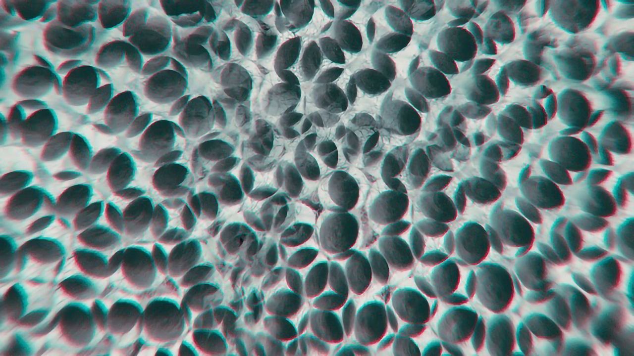 Mutation Stands in the Way of Health Blood Cell Maturation