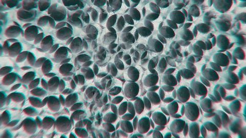 Mutation Stands in the Way of Health Blood Cell Maturation