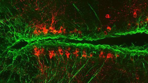 Zebrafish Show the Way to Brain Cell Regeneration in Parkinson's
