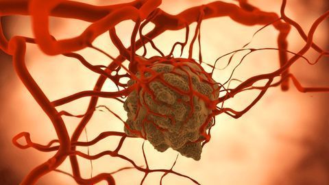Turning Tumors Into Cancer Vaccine Factories