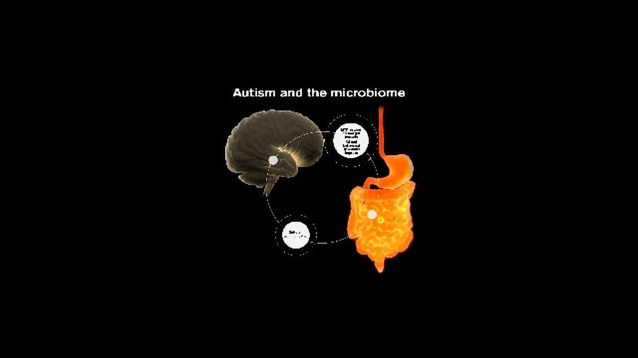 Microbiota Transplant Followed by Long-term Improvement in Autism Symptoms