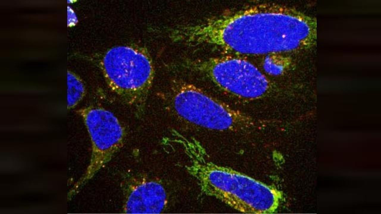 Spying on Cells' Eating Habits Could Aid Cancer Diagnosis