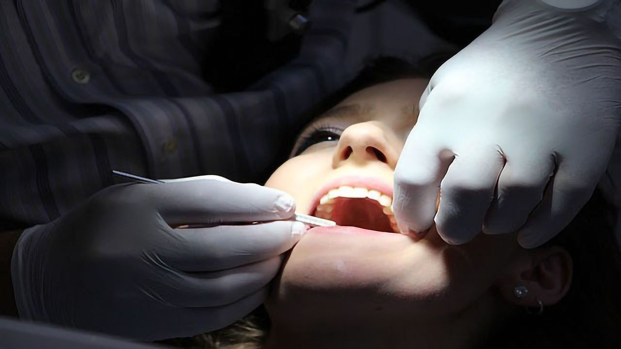 Pearly White Smiles May Come With a Cost