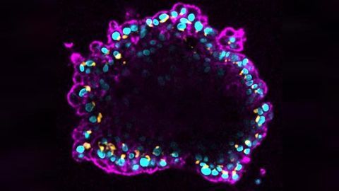 Cancer: Central Role of Cell “Skeleton” Revealed
