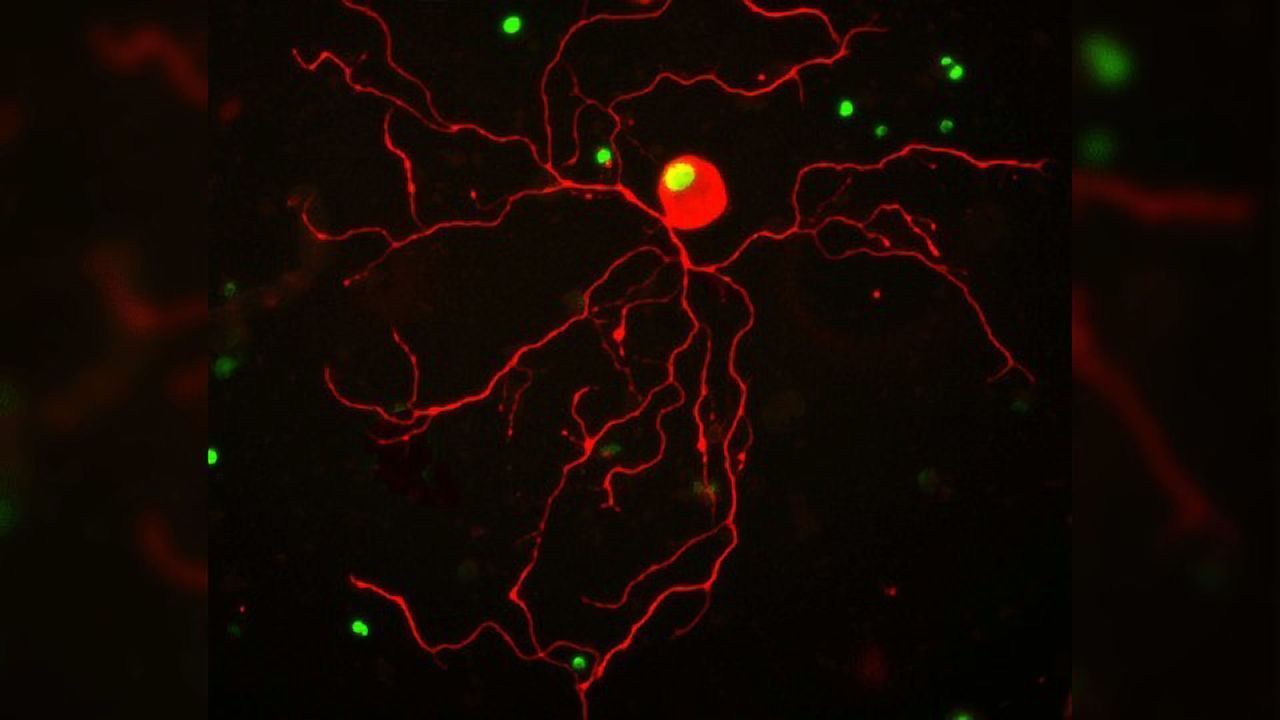 Exercise Promotes Spinal Cord Healing in Rodents via Epigenetic Mechanism
