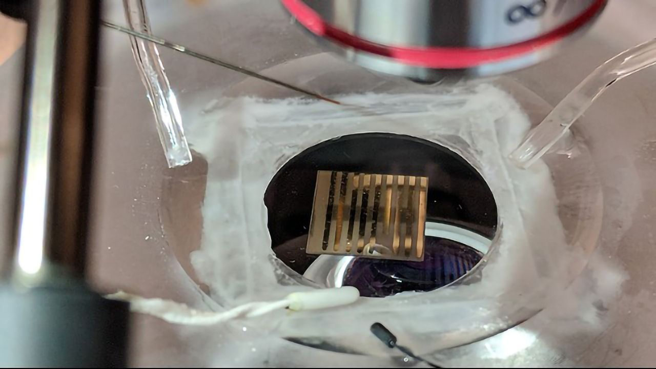 Quantum Material "Listens" to Neurological Disease