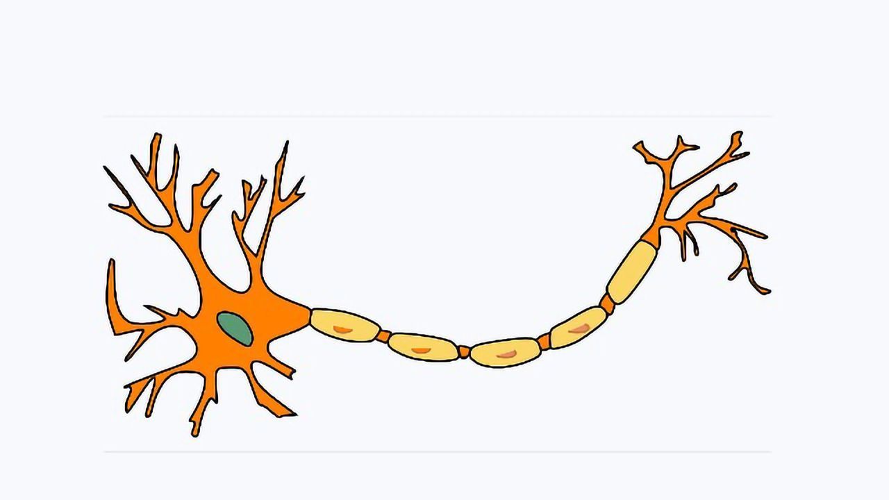 18% of MS Patients in Study Misdiagnosed