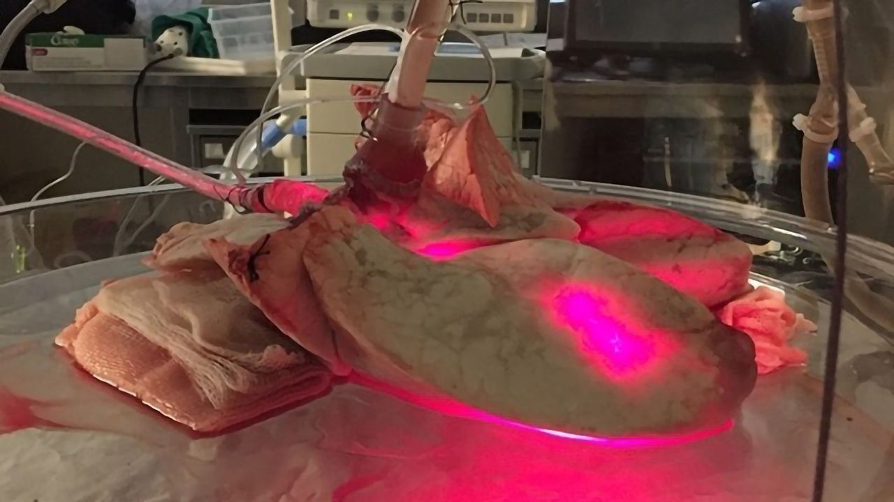 Eliminating Bacteria and Viruses From Organs Before Transplantation