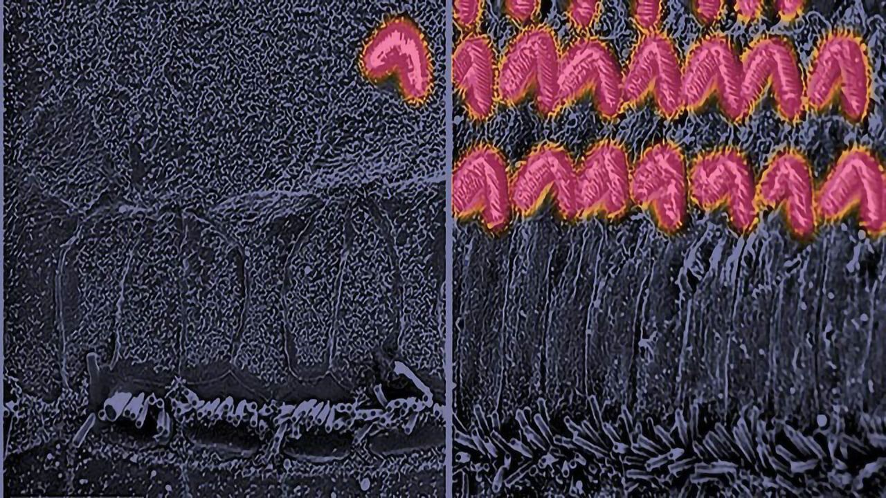 38 Newly Discovered Genes Offer Hope for Restoring Hearing