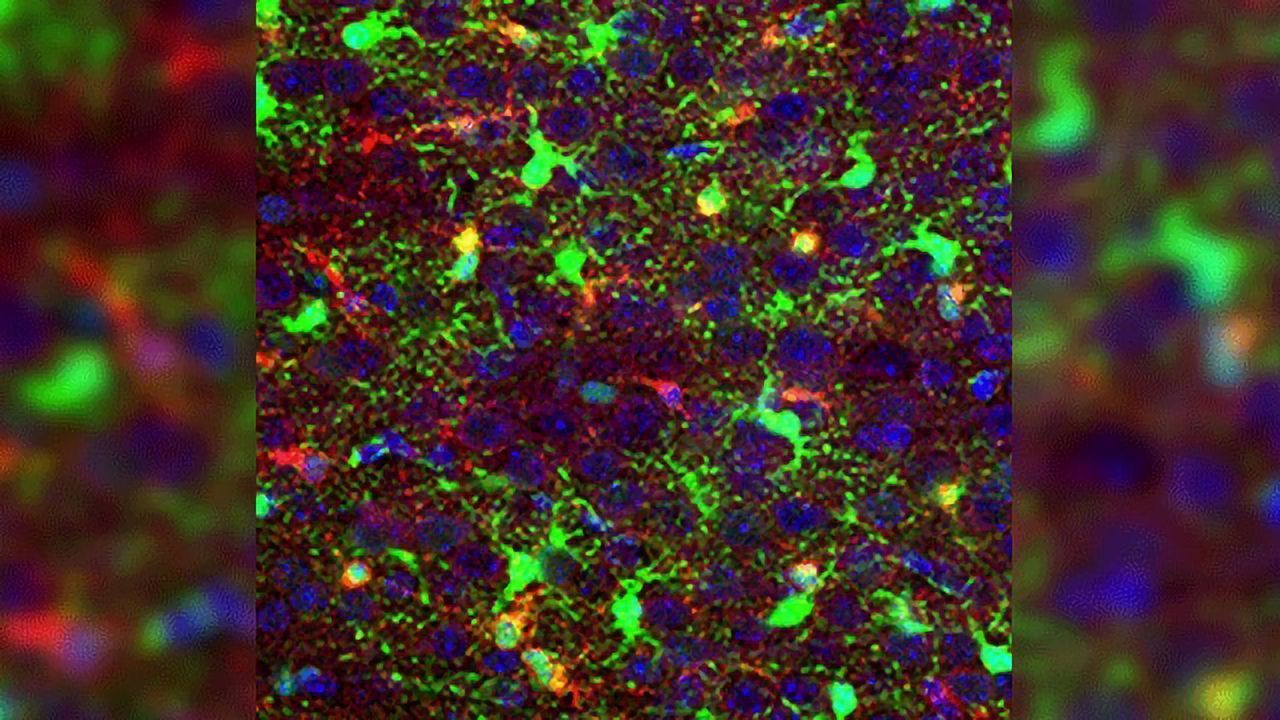 Finding Drivers of Pediatric Brain Cancer Presents Therapeutic Possibilities