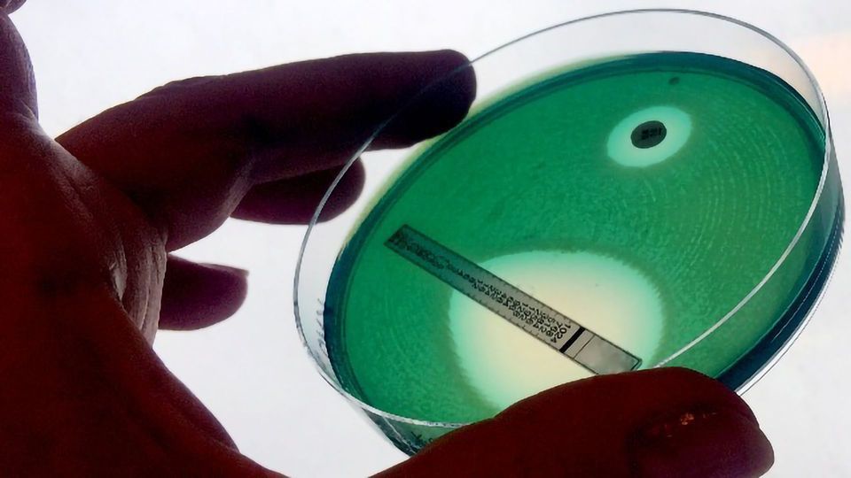 Antimicrobial Resistance: Drivers, Diagnostics and DNA content piece image