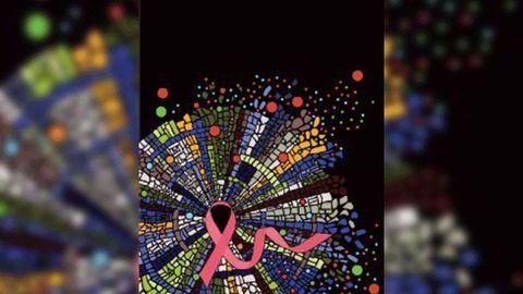 Aggressive Breast Cancers Not Necessarily More Diverse in Cell Type