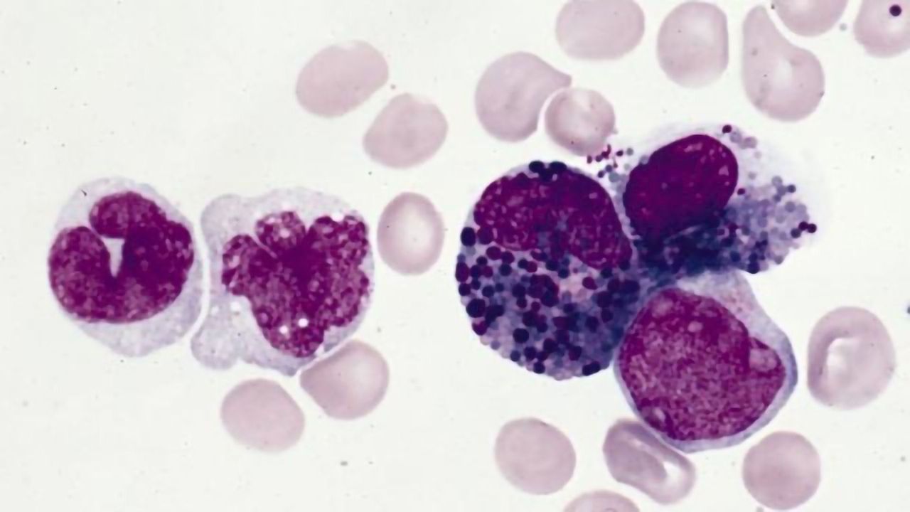 Combining CRISPR With Drug Discovery to Understand Treatment Efficacy