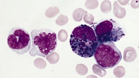 Combining CRISPR With Drug Discovery to Understand Treatment Efficacy