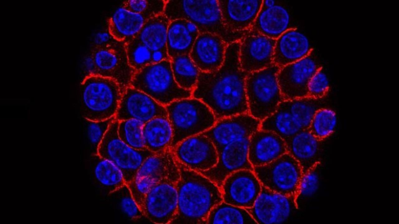 The Fluid That Feeds Tumor Cells