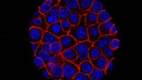 The Fluid That Feeds Tumor Cells